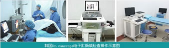 肛肠镜 肛肠镜